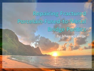 Repairing FracturedPorcelain-Fused-to-MetalBridge Pontics By: JehanneCalinga 