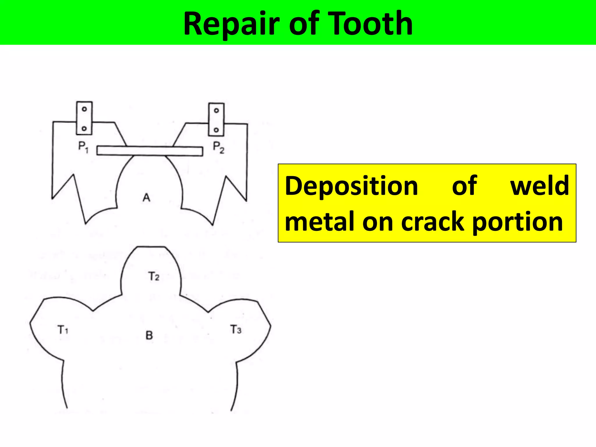 Repair of Tooth
Deposition of weld
metal on crack portion
 