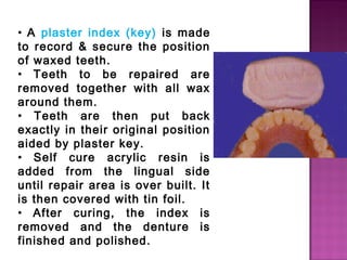 • A plaster index (key) is made
to record & secure the position
of waxed teeth.
• Teeth to be repaired are
removed together with all wax
around them.
• Teeth are then put back
exactly in their original position
aided by plaster key.
• Self cure acrylic resin is
added from the lingual side
until repair area is over built. It
is then covered with tin foil.
• After curing, the index is
removed and the denture is
finished and polished.

 
