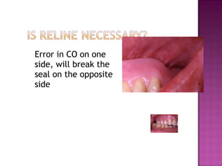 Error in CO on one
side, will break the
seal on the opposite
side

 