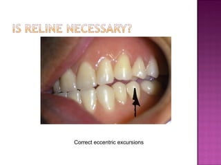 Correct eccentric excursions

 