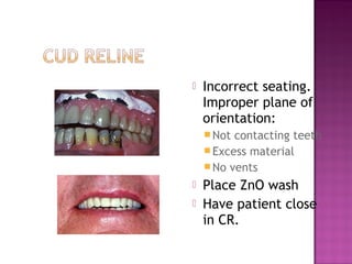 

Incorrect seating.
Improper plane of
orientation:
 Not

contacting teeth
 Excess material
 No vents



Place ZnO wash
Have patient close
in CR.

 