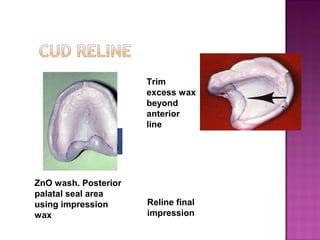 Trim
excess wax
beyond
anterior
line

ZnO wash. Posterior
palatal seal area
using impression
wax

Reline final
impression

 