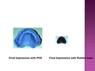 Final Impression with PVS

Final Impression with Rubber base

 