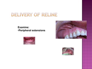 Examine:
•Peripheral extensions

 