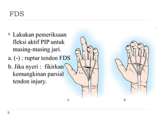 Fds Injuries ilmu kedokteran fisik Repair Tendon.pptx