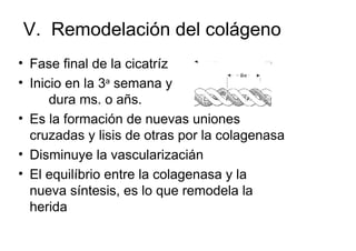 V. Remodelación del colágeno
• Fase final de la cicatríz
• Inicio en la 3a semana y
      dura ms. o añs.
• Es la formación de nuevas uniones
  cruzadas y lisis de otras por la colagenasa
• Disminuye la vascularizacián
• El equilíbrio entre la colagenasa y la
  nueva síntesis, es lo que remodela la
  herida
 