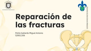 Illustration
by
Smart-Servier
Medical
Art
Reparación de
las fracturas
Polito Gallardo Miguel Antonio
S20011306
 