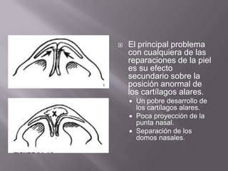 El principal problema con cualquiera de las reparaciones de la piel es su efecto secundario sobre la posición anormal de los cartílagos alares.Un pobredesarrollo de los cartílagos alares.Poca proyección de la punta nasal.Separación de los domos nasales.