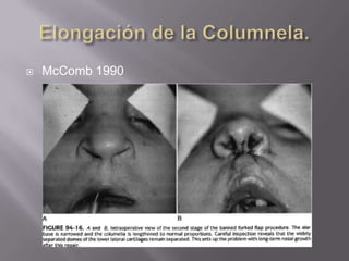 Elongación de la Columnela.McComb 1990