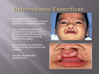Deformidades Especificas.El segmento de Vomerpremaxilar no se fusiona con los segmentos maxilares laterales.Hay acortamiento del tejido cutáneo en la longitud vertical del componente frontonasal de la punta de la nariz al borde inferior del prolabio. Los pacientes no presentan ninguna de las estructuras del prolabio.Las alas se extienden ampliamente.
