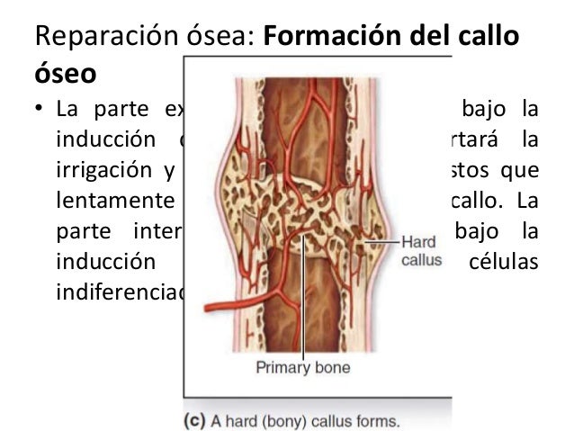 Reparación ósea