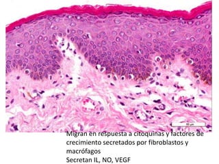 Migran en respuesta a citoquinas y factores de
crecimiento secretados por fibroblastos y
macrófagos
Secretan IL, NO, VEGF
 