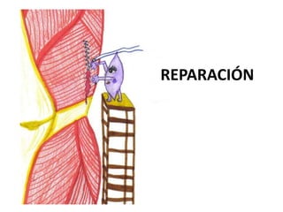 REPARACIÓN
 