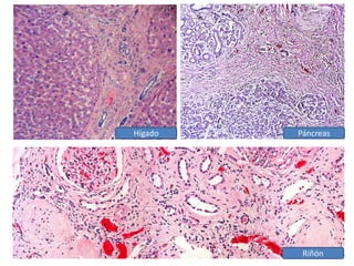 Hígado Páncreas
Riñón
 