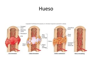 Hueso
 