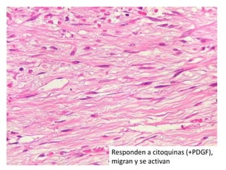 Responden a citoquinas (+PDGF),
migran y se activan
 