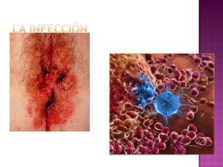 Aspectos patológicos de la inflamación y reparación