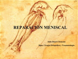REPARACIÓN MENISCAL
Julio Duart Clemente
Dpto. Cirugía Ortopédica y Traumatología
 