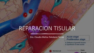 REPARACION TISULAR
Dra. Claudia Melisa Toledano Torres
 
