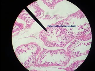 Diego Rivera , Joshua Alvarado
 