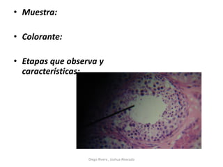 • Muestra:
• Colorante:
• Etapas que observa y
características:
Diego Rivera , Joshua Alvarado
 