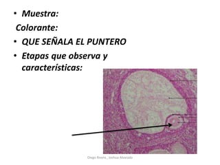 • Muestra:
Colorante:
• QUE SEÑALA EL PUNTERO
• Etapas que observa y
características:
Diego Rivera , Joshua Alvarado
 
