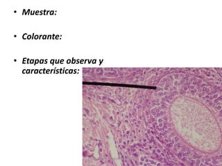 • Muestra:
• Colorante:
• Etapas que observa y
características:
Diego Rivera , Joshua Alvarado
 