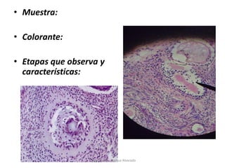 • Muestra:
• Colorante:
• Etapas que observa y
características:
Diego Rivera , Joshua Alvarado
 