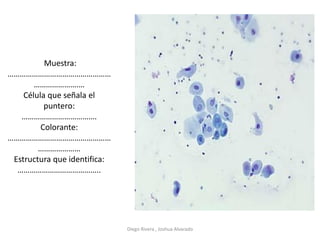 Muestra:
……………………………………………
………………….…
Célula que señala el
puntero:
……………………………….
Colorante:
……………………………………………
…………………
Estructura que identifica:
…………………………………..
Diego Rivera , Joshua Alvarado
 