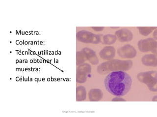 • Muestra:
• Colorante:
• Técnica utilizada
para obtener la
muestra:
• Célula que observa:
Diego Rivera , Joshua Alvarado
 