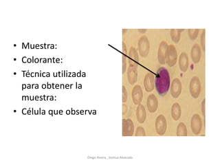 • Muestra:
• Colorante:
• Técnica utilizada
para obtener la
muestra:
• Célula que observa
Diego Rivera , Joshua Alvarado
 