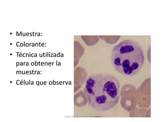 • Muestra:
• Colorante:
• Técnica utilizada
para obtener la
muestra:
• Célula que observa
Diego Rivera , Joshua Alvarado
 