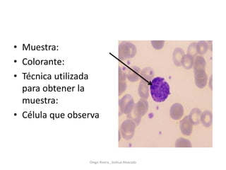 • Muestra:
• Colorante:
• Técnica utilizada
para obtener la
muestra:
• Célula que observa
Diego Rivera , Joshua Alvarado
 