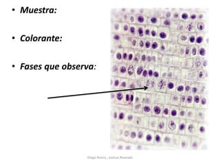 • Muestra:
• Colorante:
• Fases que observa:
Diego Rivera , Joshua Alvarado
 