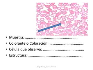 • Muestra: ……………………………………………….
• Colorante o Coloración: ………………………………
• Célula que observa: …………………………………….
• Estructura: …………………………………………………
Diego Rivera , Joshua Alvarado
 