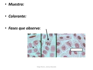 • Muestra:
• Colorante:
• Fases que observa:
Diego Rivera , Joshua Alvarado
 