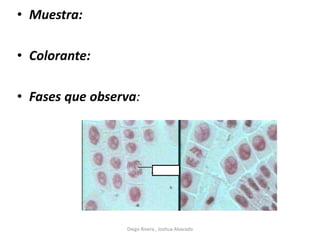 • Muestra:
• Colorante:
• Fases que observa:
Diego Rivera , Joshua Alvarado
 