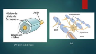 SNP 1 mm cada 6 meses
SNC
 