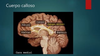 Cuerpo calloso
 