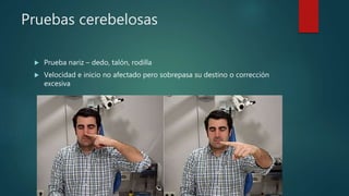Pruebas cerebelosas
 Prueba nariz – dedo, talón, rodilla
 Velocidad e inicio no afectado pero sobrepasa su destino o corrección
excesiva
 