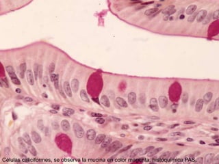 Células caliciformes, se observa la mucina en color magenta, histoquímica PAS.
 