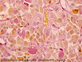 Células endócrinas de la adenohipófisis, histoquímica PAS y Orange G.
 