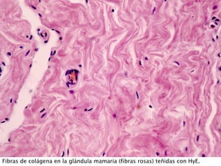 Fibras de colágena en la glándula mamaria (fibras rosas) teñidas con HyE.
 