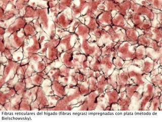 Fibras reticulares del hígado (fibras negras) impregnadas con plata (método de
Bielschowvsky).
 