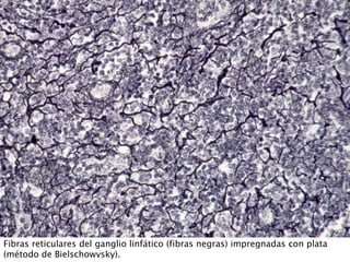 Fibras reticulares del ganglio linfático (fibras negras) impregnadas con plata
(método de Bielschowvsky).
 