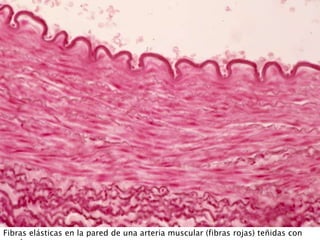 Fibras elásticas en la pared de una arteria muscular (fibras rojas) teñidas con
 