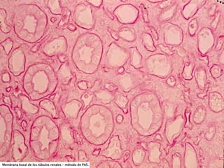 Membrana basal de los túbulos renales – método de PAS.
 
