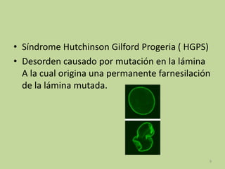 • Síndrome Hutchinson Gilford Progeria ( HGPS)
• Desorden causado por mutación en la lámina
A la cual origina una permanente farnesilación
de la lámina mutada.

9

 