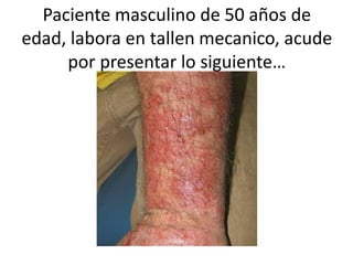 Paciente masculino de 50 años de
edad, labora en tallen mecanico, acude
por presentar lo siguiente…
 